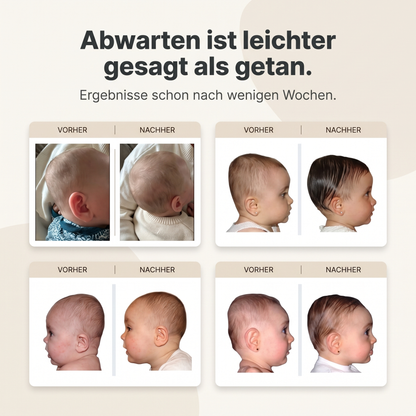 Baby Frey™ Lagerungskissen gegen Kopfverformung