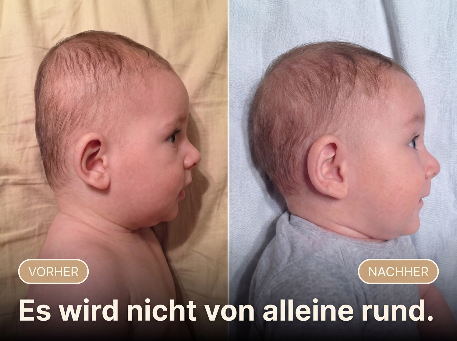 Vorher Nachher: Es wird nicht von alleine rund dank Baby Frey Kissen